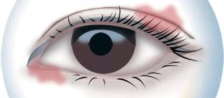 CBA***得分手發高燒吸氧0得分 教練：賓館房間新裝修，甲醛中毒導致的！